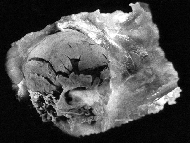 Cranium burning in the crematorium incinerator